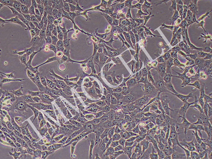 4T1-GFP-puro小鼠乳腺癌细胞(GFP标记)