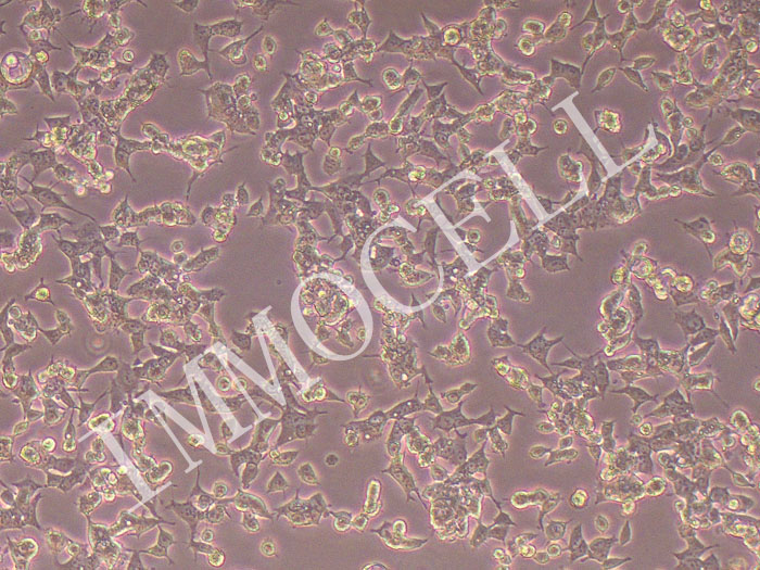 C666-1-GFP-puro人鼻咽癌细胞 (GFP标记)