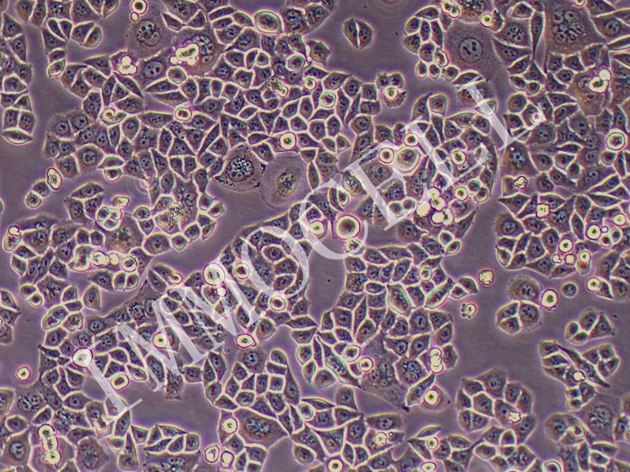RWPE-1-FLUC-puro人正常前列腺上皮细胞  (FLUC标记)