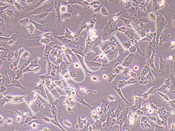 U-118MG-FLUC-puro人脑星形胶质母细胞瘤(FLUC标记)