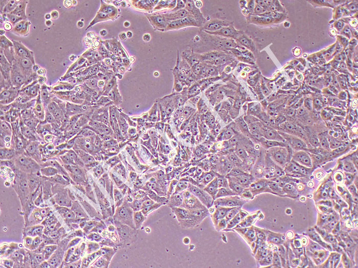 MCF7/Palbociclib人乳腺癌帕博西尼耐药株