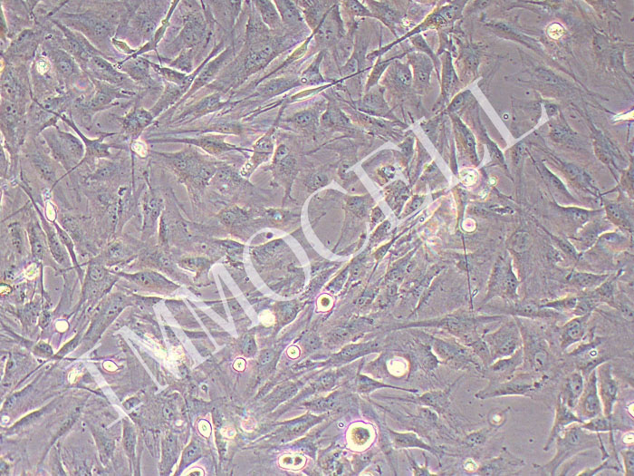 NCI-H2452人间皮瘤细胞（STR鉴定正确）