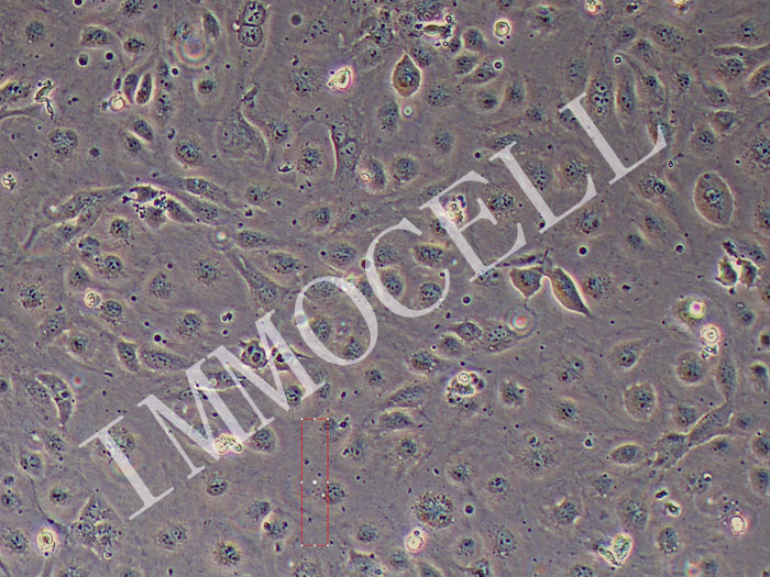 HCMEC-SV40T人心脏微血管内皮细胞永生化