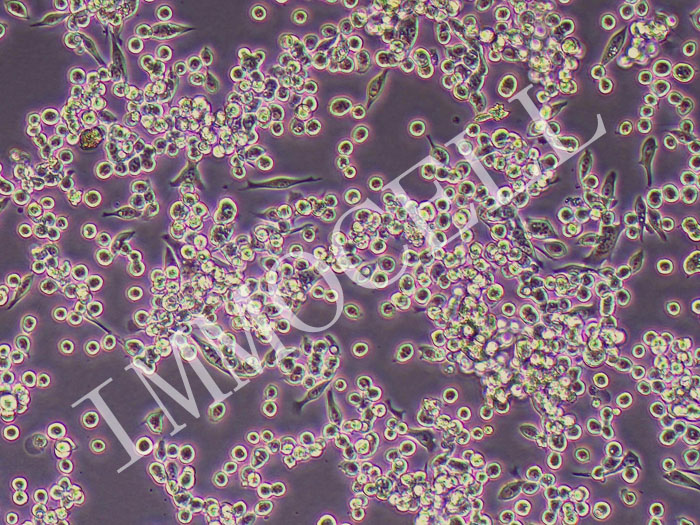 MKN-45/Oxaliplatin人胃癌奥沙利铂耐药株（STR鉴定正确）