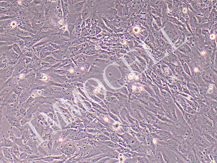 sNF96.2人雪旺细胞永生化/施万细胞（STR鉴定正确）