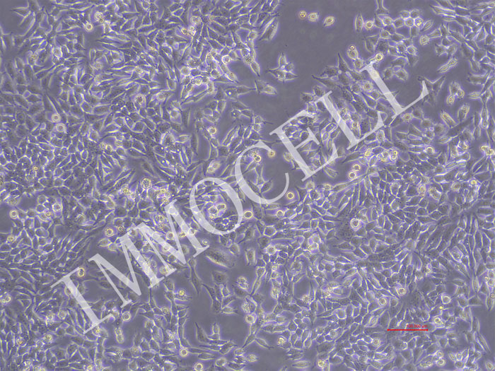 HGC27-RFP-puro人胃癌细胞-RFP标记-puro抗性