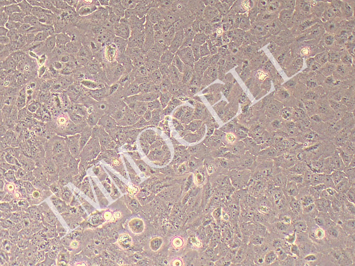 HuCCT1-FLUC-puro 人胆管癌细胞 (FLUC标记)