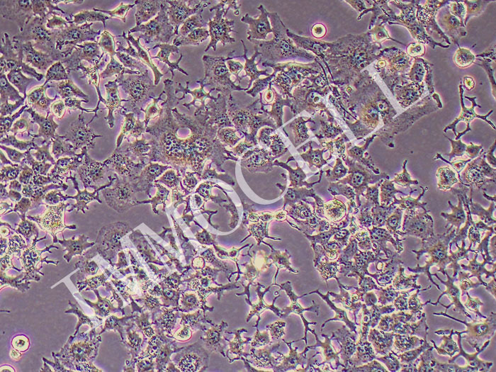 Huh7-FLUC-puro人肝癌细胞(FLUC标记)