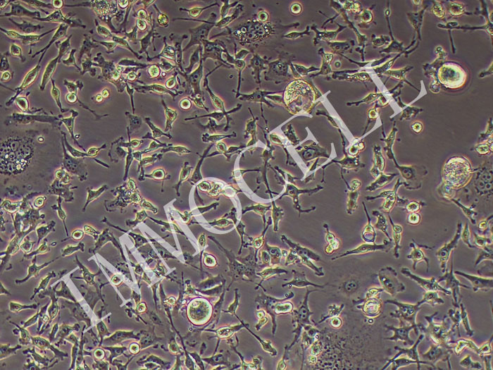 MDA-MB-436-FLUC-puro人乳腺癌细胞(FLUC标记)