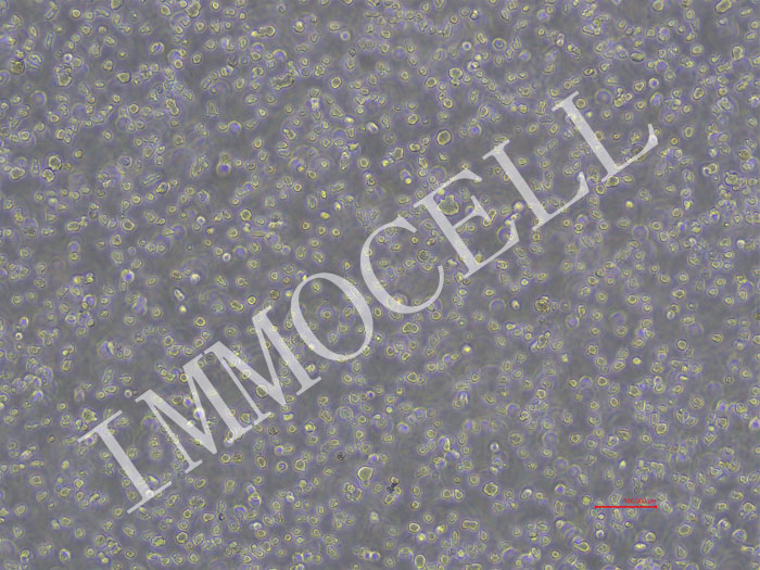 NCI-H929-NLUC-puro人骨髓瘤细胞(NLUC标记)