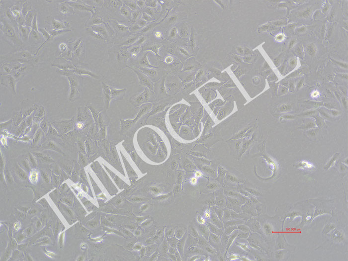 RBE-NLUC-bsd人肝胆管癌细胞-NLUC标记-bsd抗性