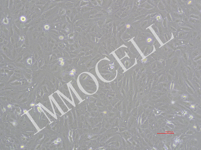RBE-NLUC-puro人肝胆管癌细胞-NLUC标记-puro抗性