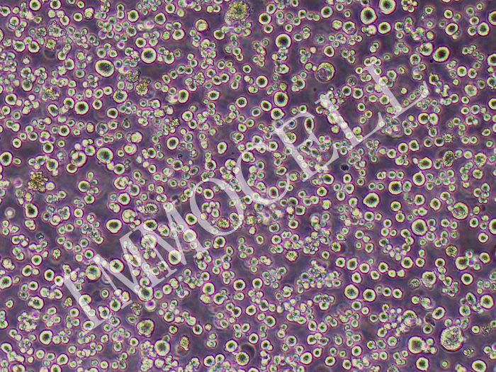 H22小鼠肝癌细胞（STR鉴定正确）