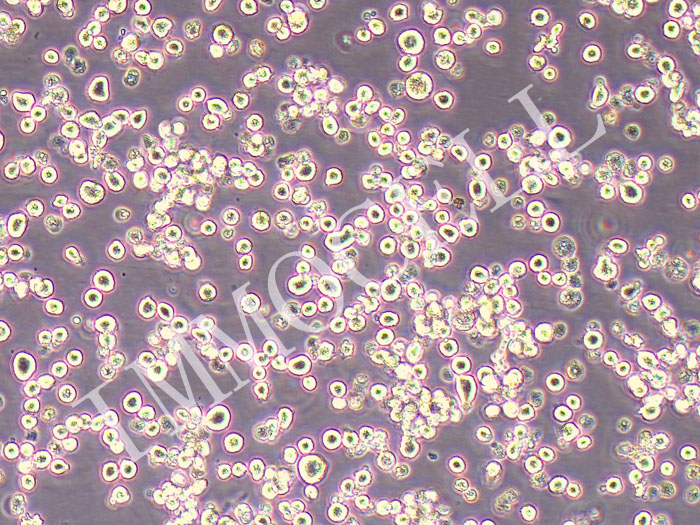 RPMI8226人多发性骨髓瘤外周血B淋巴细胞（STR鉴定正确）