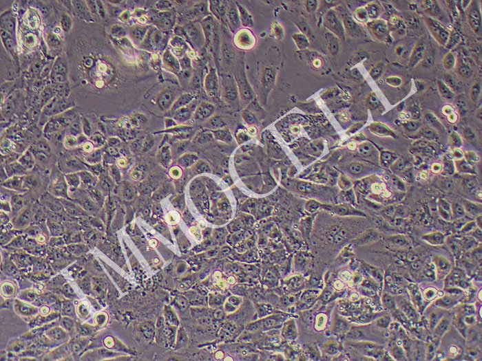 EFO-27人卵巢腺癌细胞
