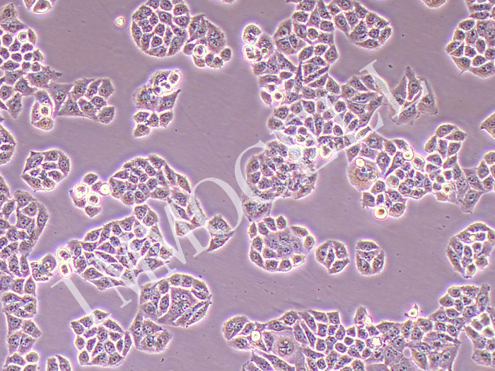 RWPE-2人前列腺正常细胞（STR鉴定正确）
