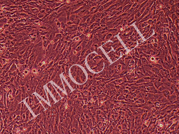 大鼠肺动脉平滑肌细胞永生化