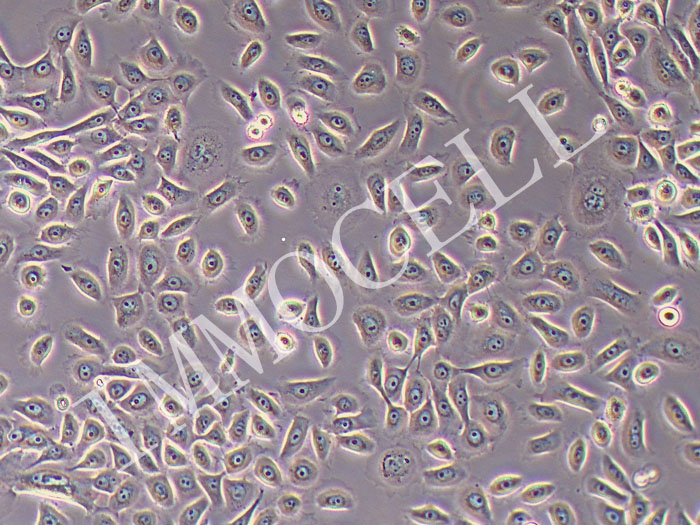 HSC-3人口腔鳞状癌细胞（STR鉴定正确）