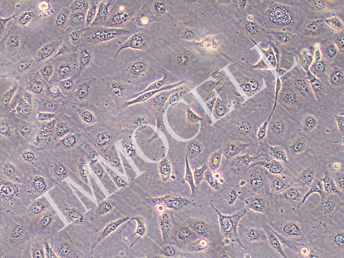 NCI-H1975/Osimertinib人肺腺癌耐奥希替尼细胞