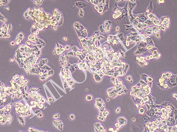 HepG2/ADR人肝癌阿霉素耐药株（STR鉴定正确）