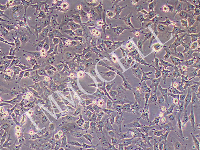 MUM2B人侵袭性脉络膜黑色素瘤细胞（STR鉴定正确）