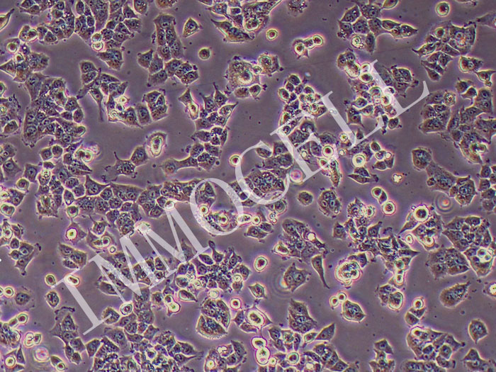 Ishikawa人子宫内膜癌细胞（STR鉴定正确）