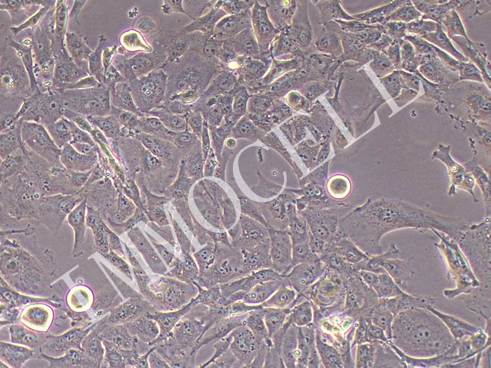 NCI-H2052人肺间皮瘤细胞（STR鉴定正确）