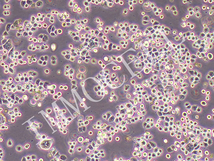 NUGC-4人胃癌细胞（STR鉴定正确）