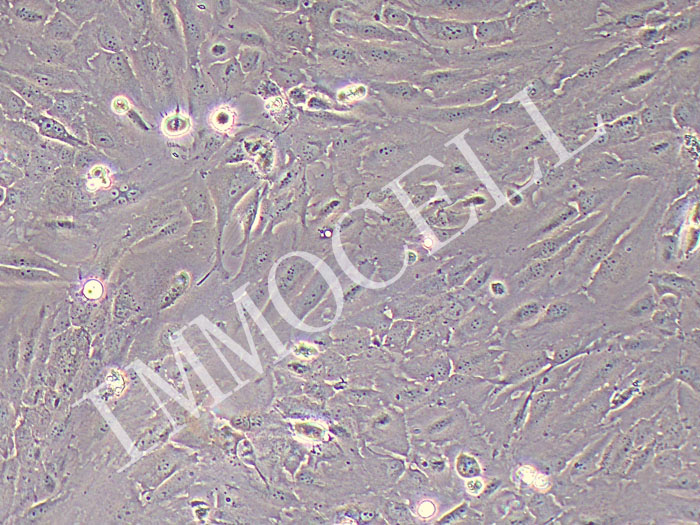 ETK-1人肝内胆管癌细胞