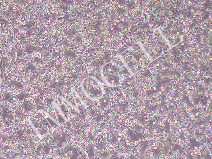 Nb2-11大鼠淋巴瘤细胞