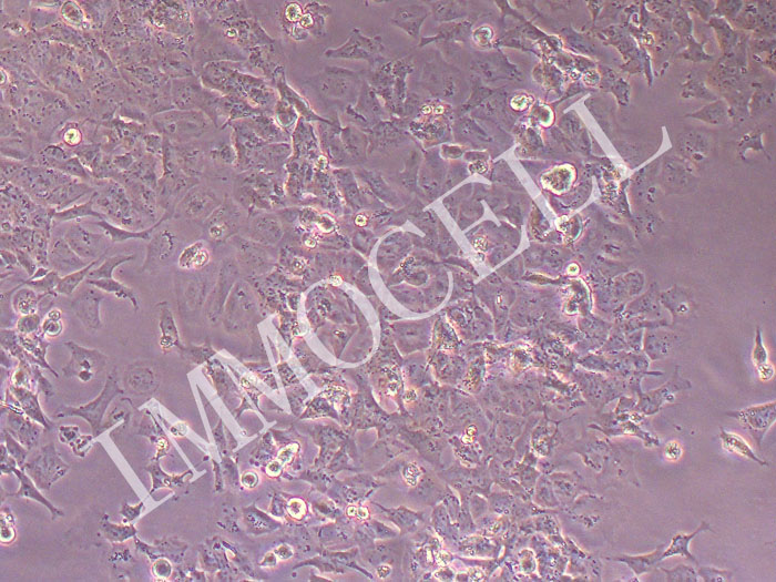 KELLY人神经母细胞瘤细胞（STR鉴定正确）