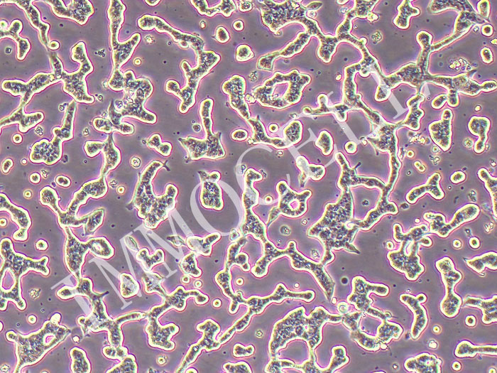SNU-719人胃癌细胞（STR鉴定正确）