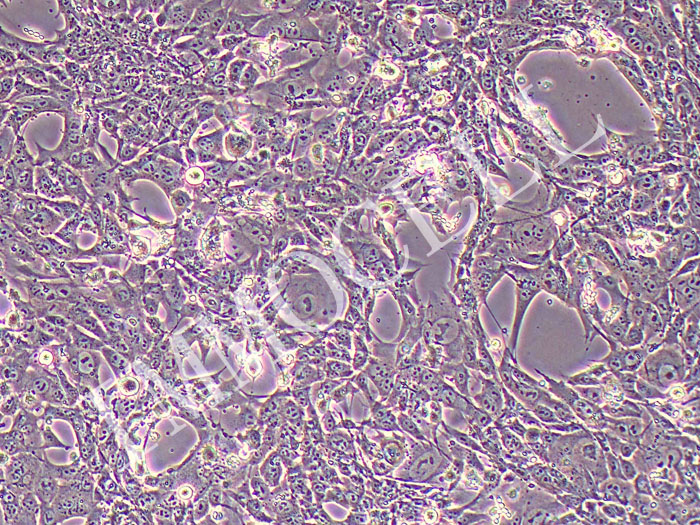 PY8119小鼠恶性乳腺癌细胞（STR鉴定正确）