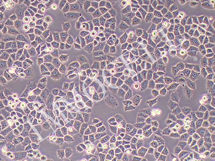 IOSE-80人正常卵巢上皮细胞系