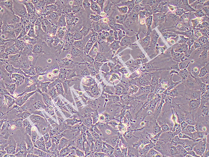 Hep3B2.1-7人肝癌细胞