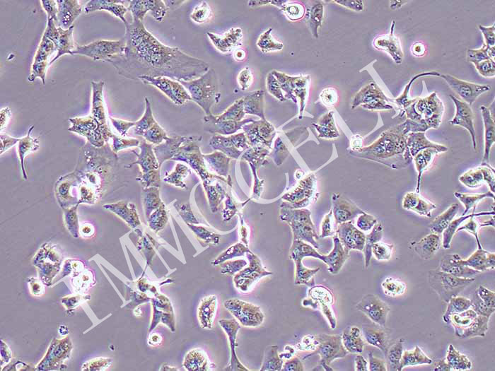 HCC-LM3人高转移肝癌细胞