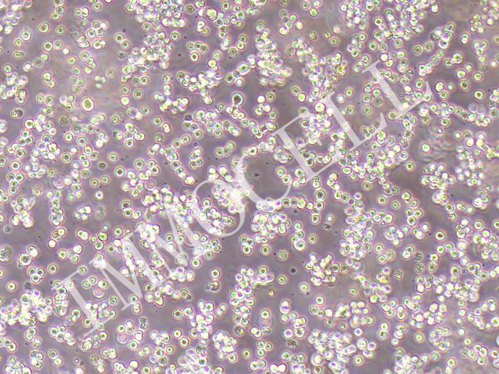 Daudi人Burkitt's淋巴瘤细胞（STR鉴定正确）