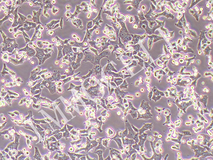 INS-1大鼠胰岛细胞瘤细胞（种属鉴定正确）