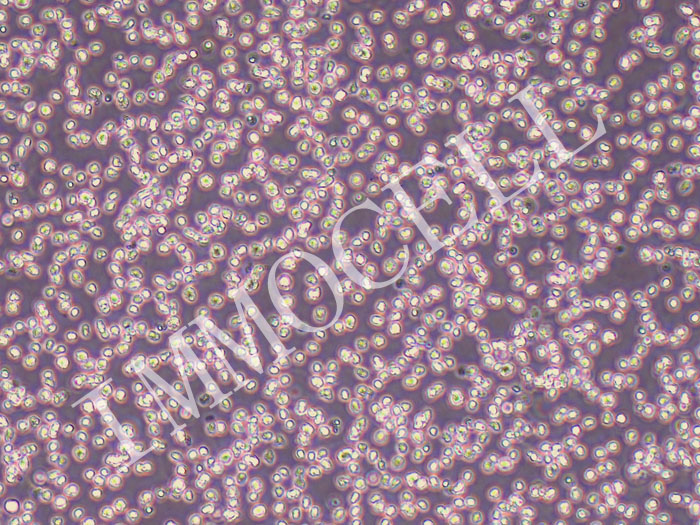 NALM-6人B淋巴白血病细胞（STR鉴定正确）