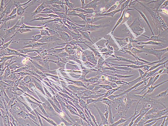 人类风湿关节炎成纤维样滑膜细胞永生化