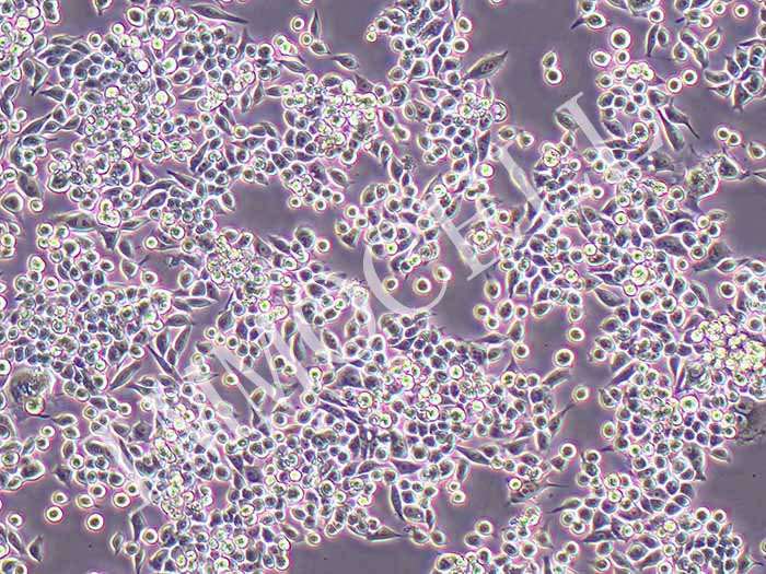 MKN-45人胃癌细胞（STR鉴定正确）
