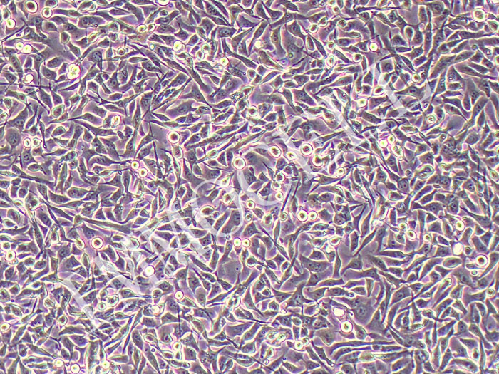 B16小鼠黑色素瘤细胞
