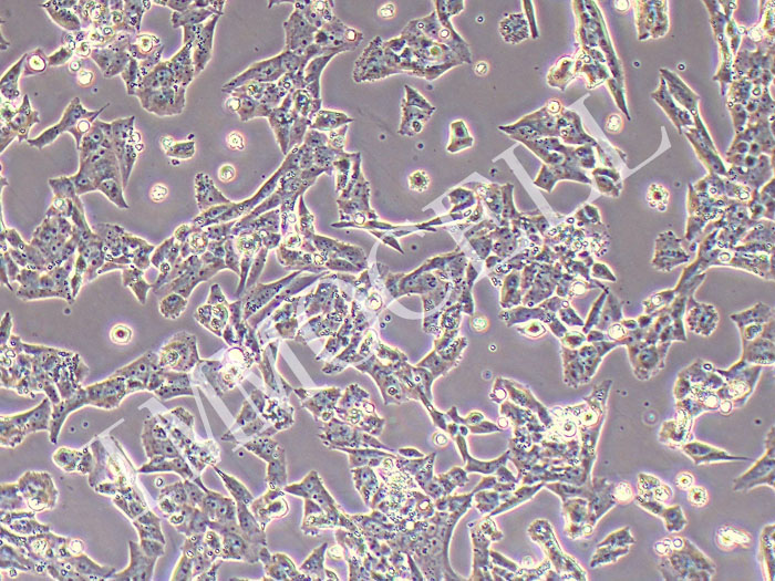 NCI-H295R人肾上腺皮质腺癌细胞