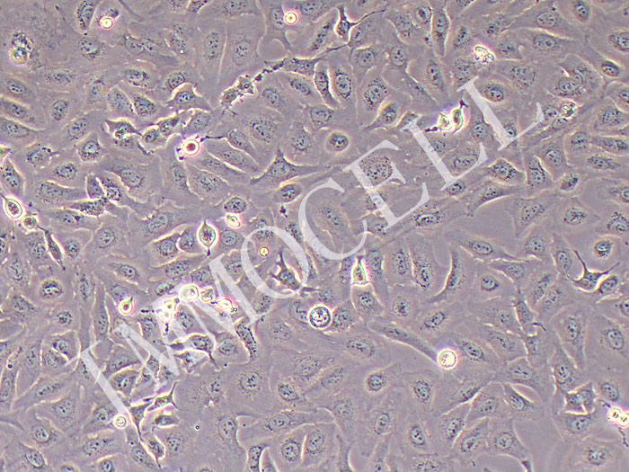 SKOV3人卵巢癌细胞（STR鉴定正确）