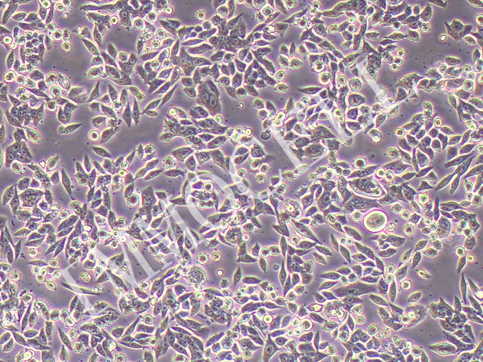 SW620人结直肠腺癌细胞（STR鉴定正确）