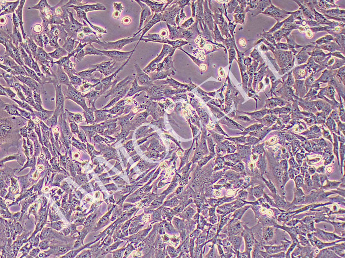 CT-2A小鼠胶质母细胞瘤（STR鉴定正确）