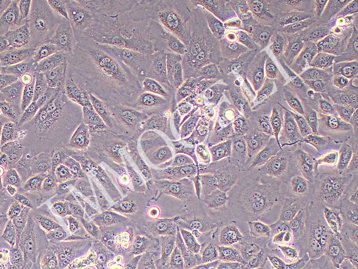 OV56人卵巢癌细胞（STR鉴定正确）