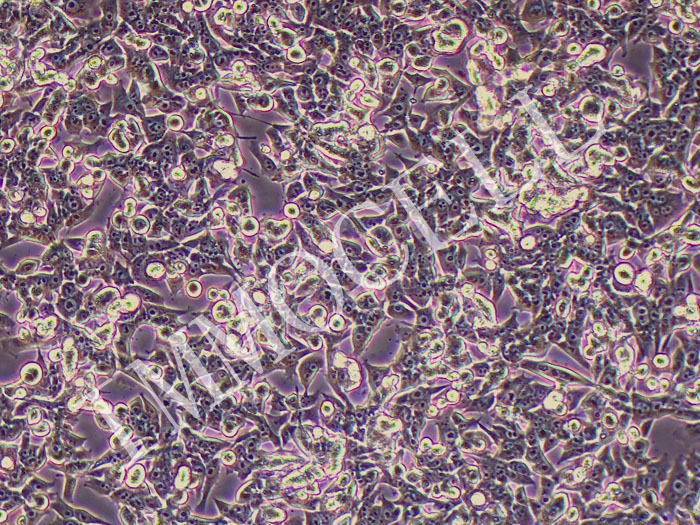 myc-cap小鼠前列腺癌细胞