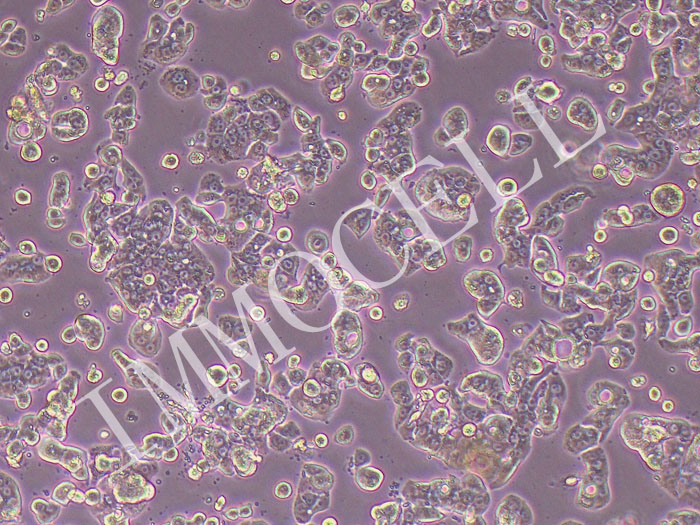 HT-29-MTX-E12人结肠癌细胞HT29甲氨蝶呤诱导分化成熟杯状细胞（STR鉴定正确）
