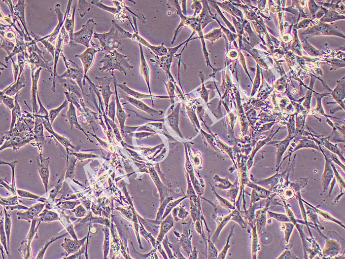 1321N1人脑部多形性成釉细胞瘤细胞